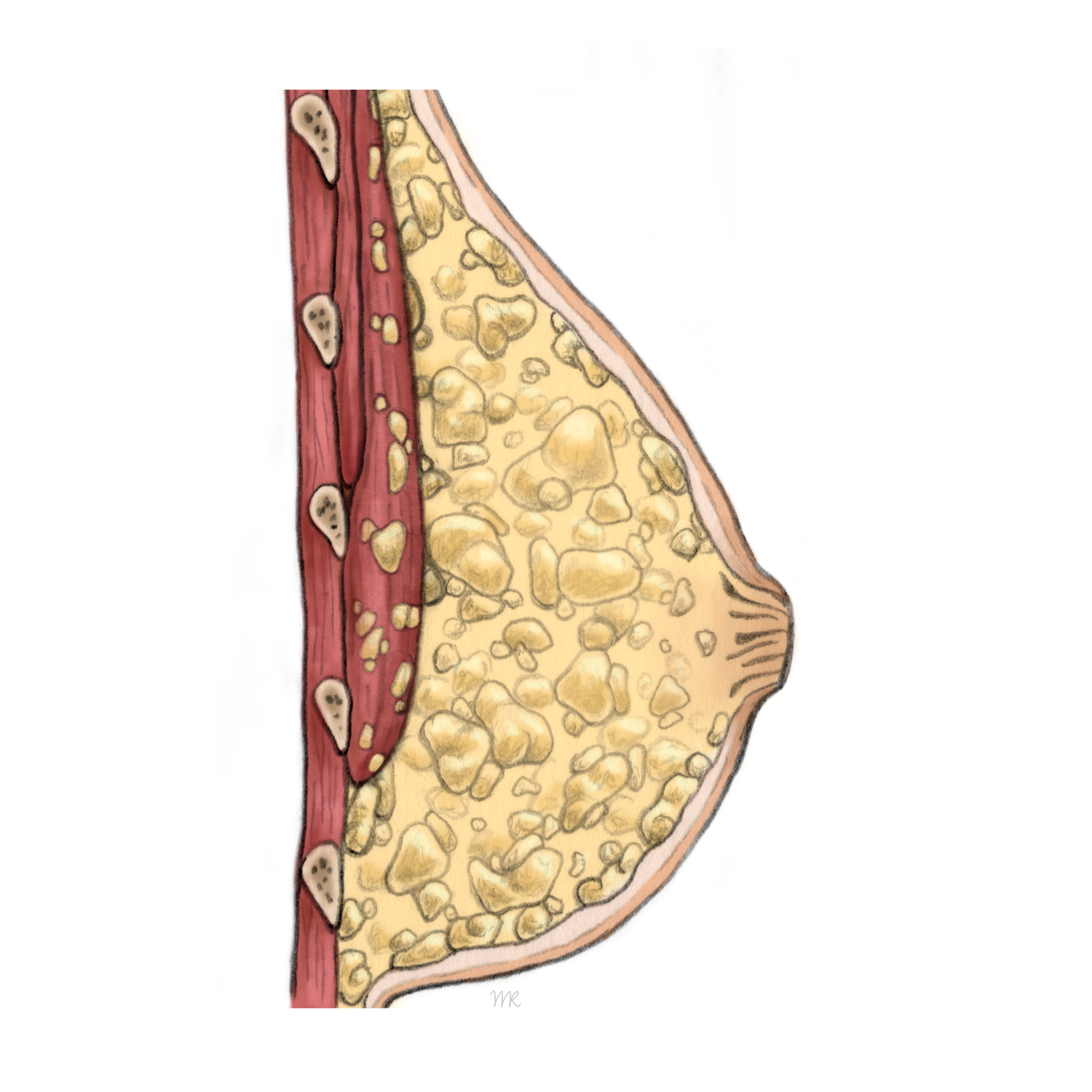 Querschnitt einer weiblichen Brust Illustration