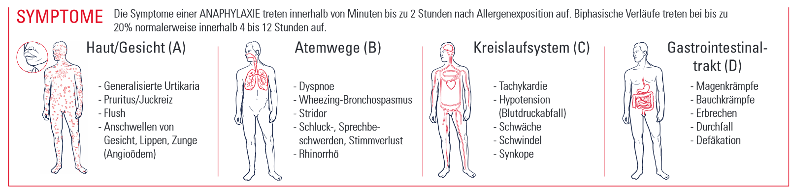 Illustration Symptome bei Inseketengiftallergie