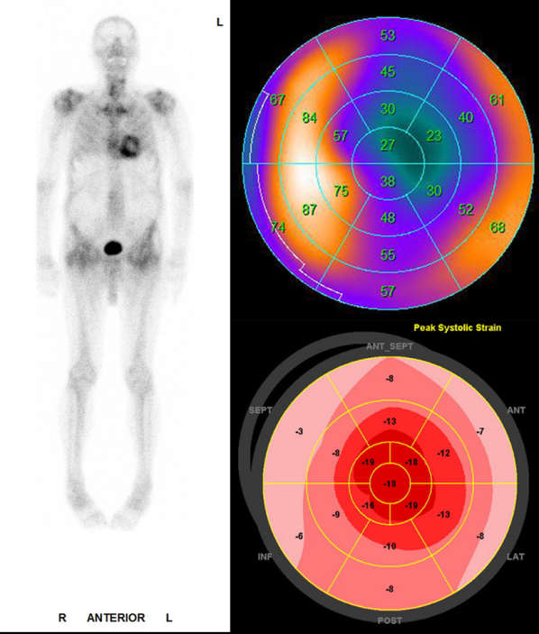 Various imaging of the heart