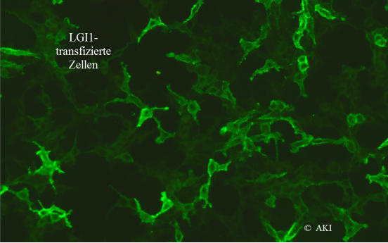 LGl1 transfizierte Zellen Fluoreszenzaufnahme