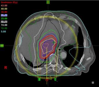 MRI Bild einer Leber