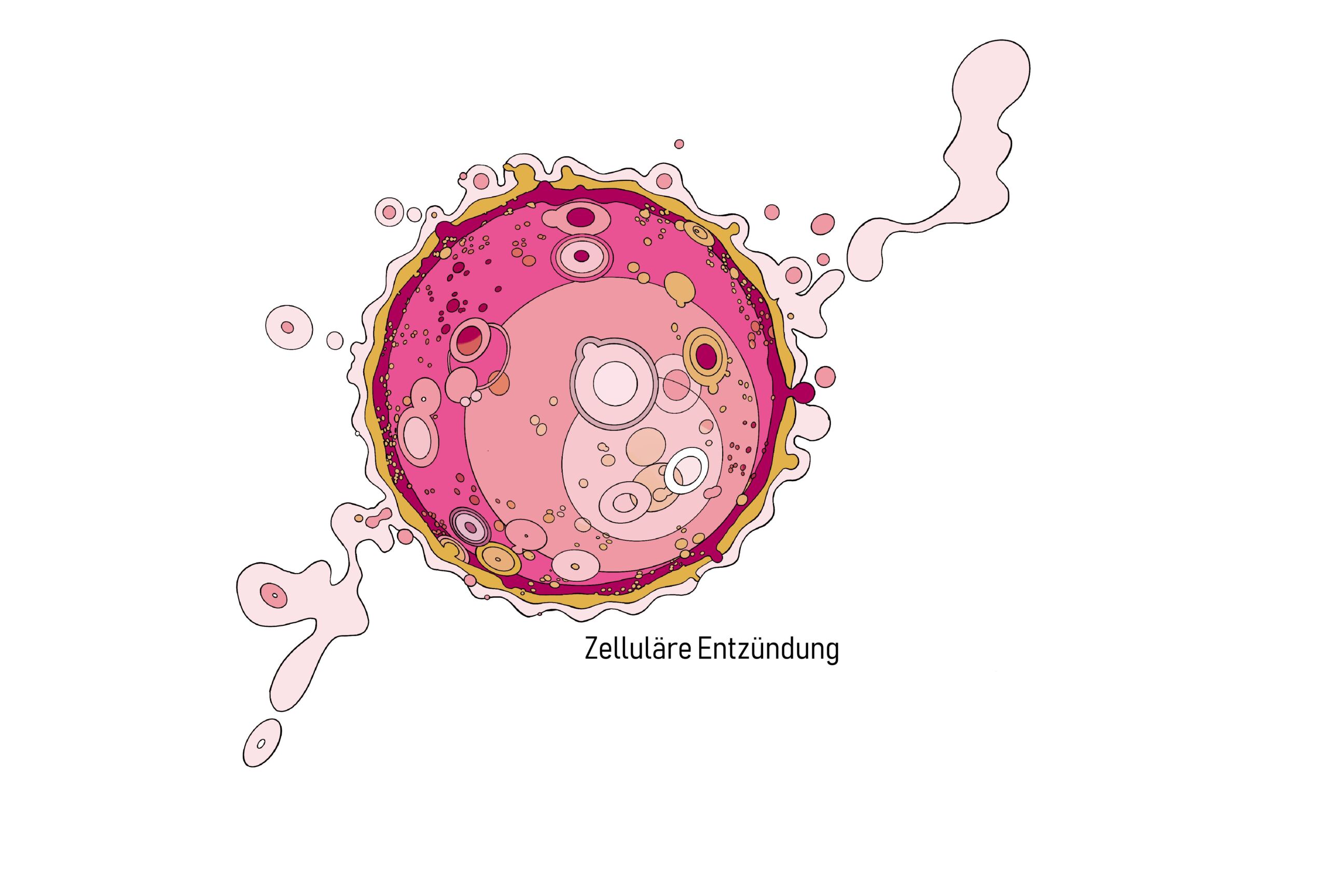 Illustration einer entzündeten Zelle