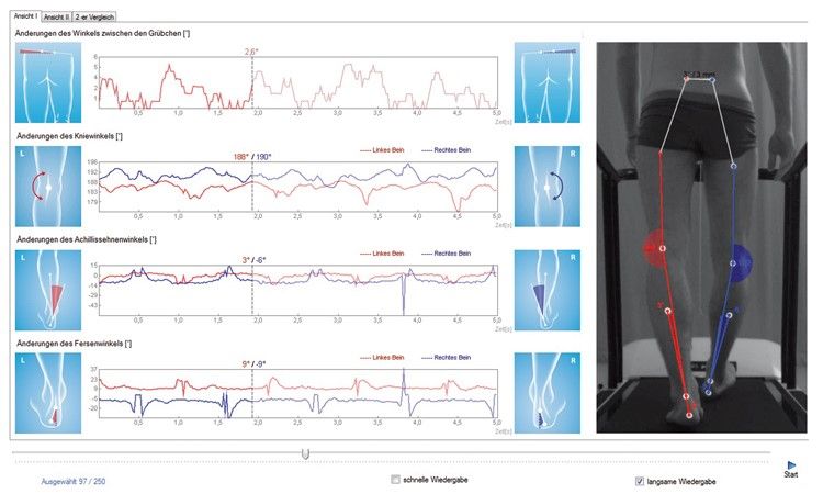 Darstellung von Daten der Ganganalyse