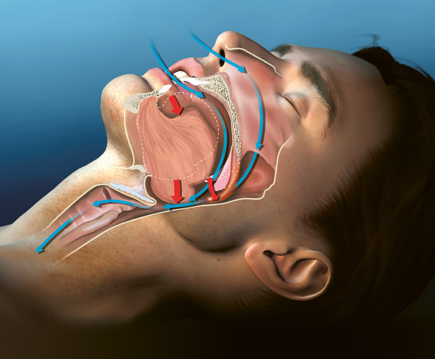 Illustration of a man sleeping to illustrate snoring