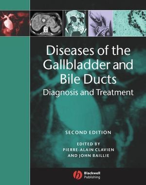Buch Cover Disease of the Gallbladder and Bile Ducts