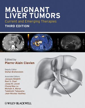 Buch Cover Malignant Liver Tumors