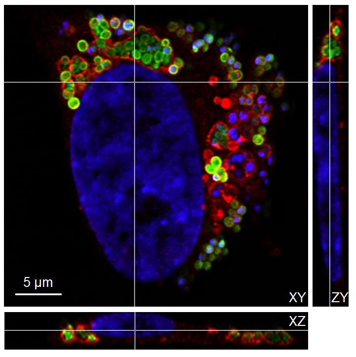 A human cell harbors bacteria in the lysosomes.