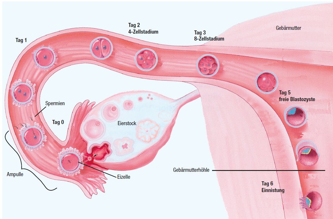 Befruchtung in der Ampulle (= äusseres Ende) des Eileiters mit Wanderung der befruchteten Eizelle durch den Eileiter. Am 5. Tag erreicht die freie Blastozyste die Gebärmutterhöhle. Die Einnistung erfolgt am 6. Tag nach der Befruchtung.