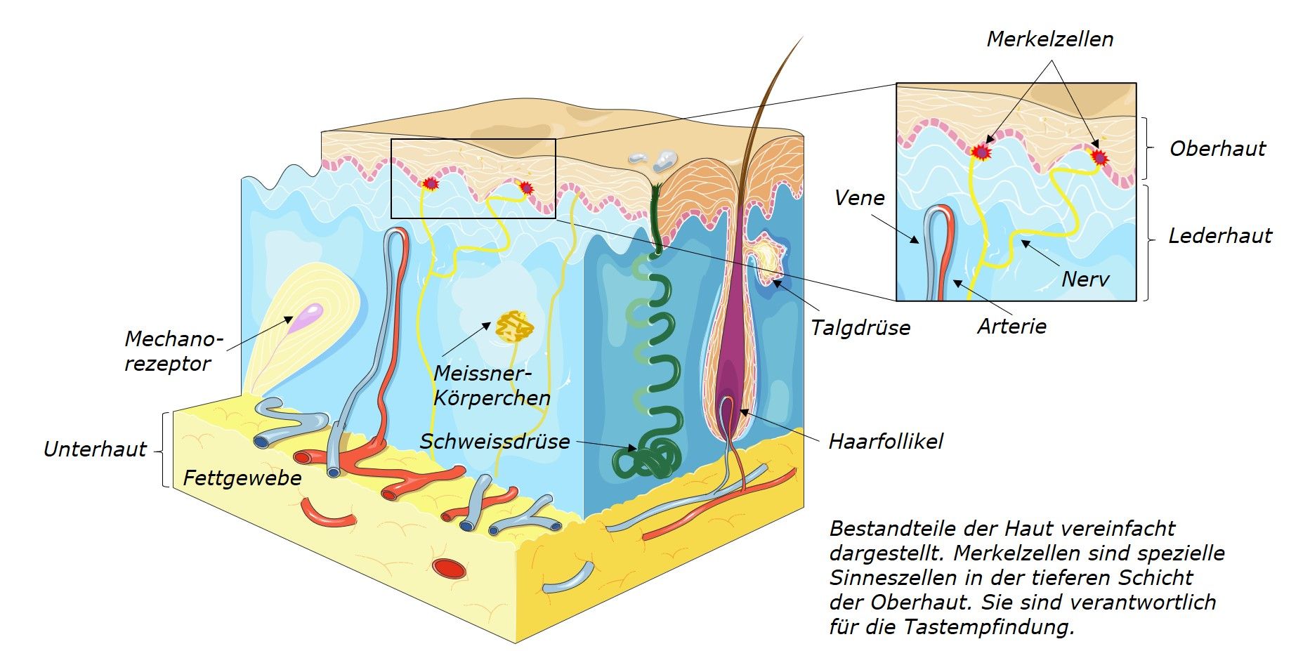 Illustration eines Merkelzellkarzinoms