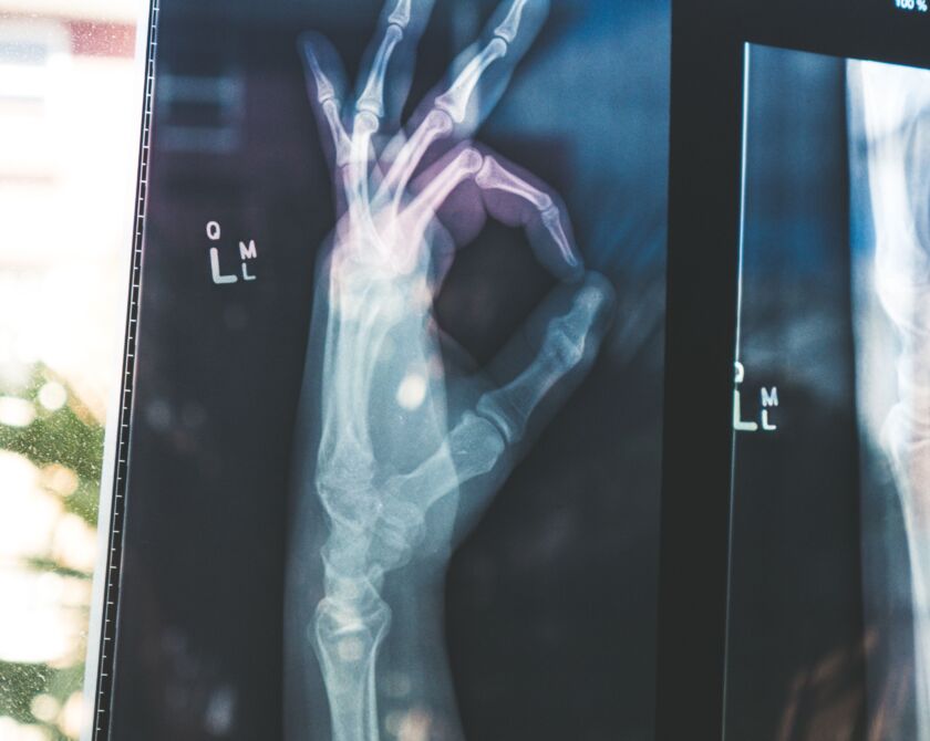 Röntgenaufnahme einer Hand