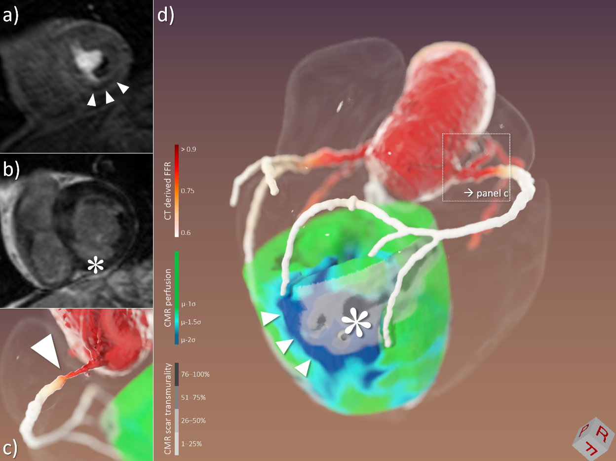 3D Image of a heart