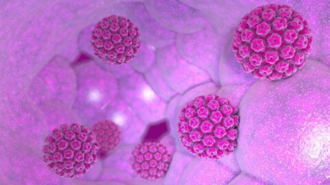 HPV-fertőzés tünetei és kezelése - Hpv vírus krebsabstrich