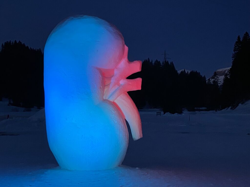 Diese mit drei Metern rekordverdächtig hohe Niere aus Schnee hat eine Botschaft: «Eine Niere reicht, um ein Leben zu retten».