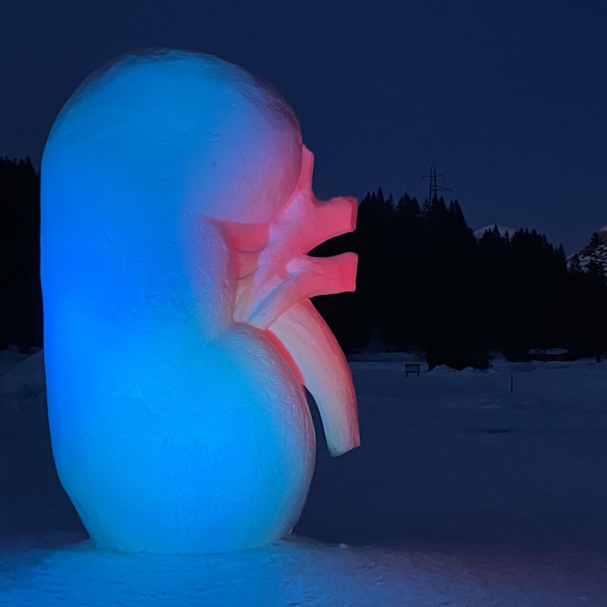 Diese mit drei Metern rekordverdächtig hohe Niere aus Schnee hat eine Botschaft: «Eine Niere reicht, um ein Leben zu retten».