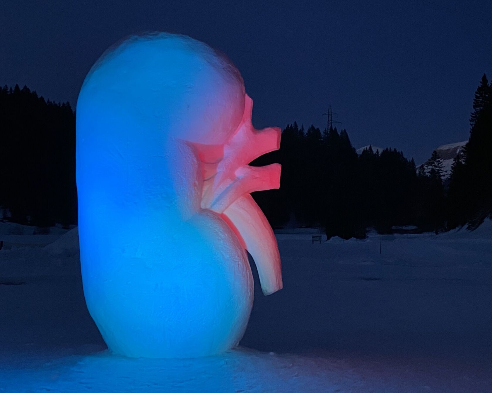 Diese mit drei Metern rekordverdächtig hohe Niere aus Schnee hat eine Botschaft: «Eine Niere reicht, um ein Leben zu retten».
