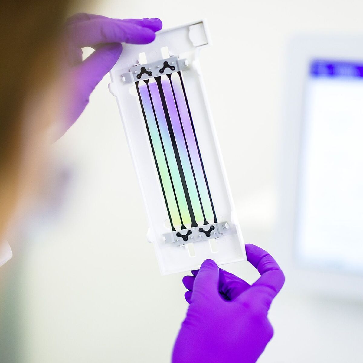 Tumorprofil im Labor