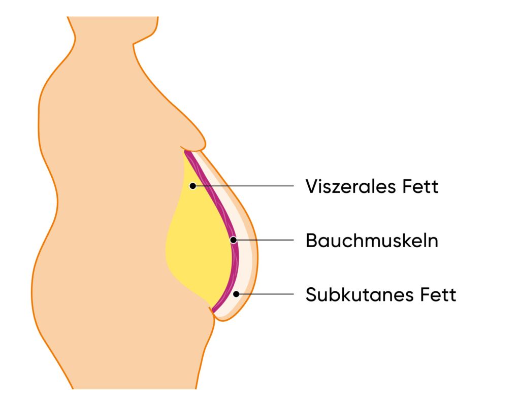 Illustration Fettverteilung Bauchfett