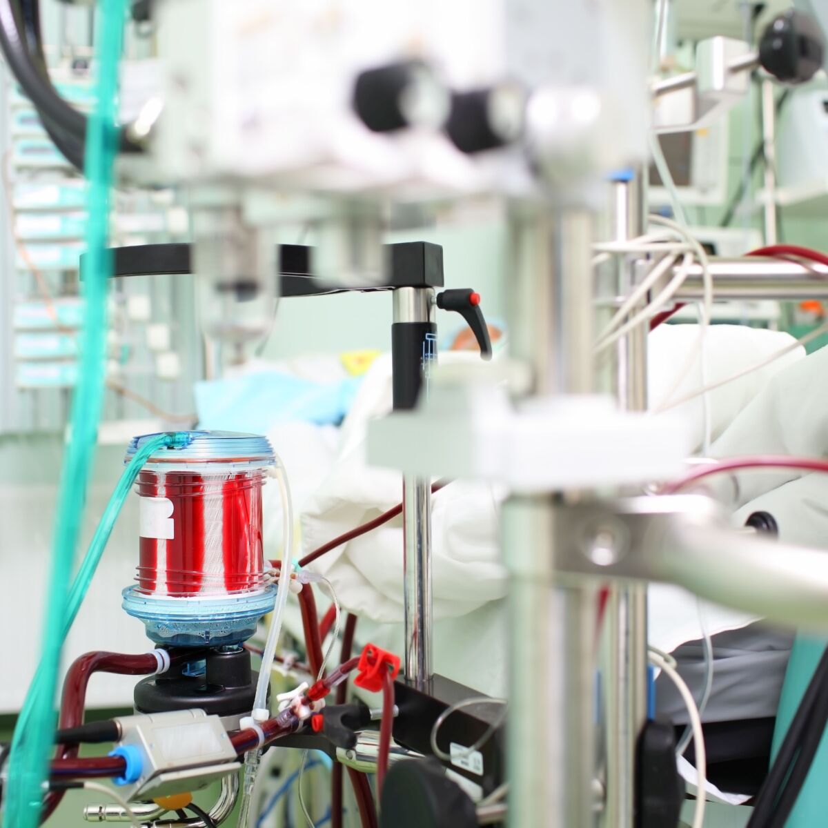 Herz-Lungen-Maschine