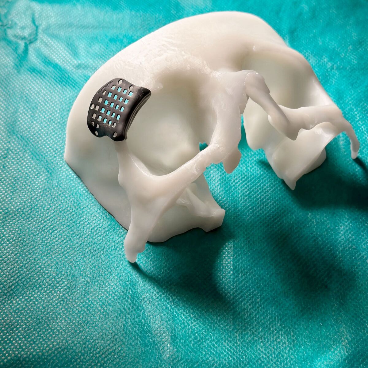 Teil des Schädels in 3D modelliert