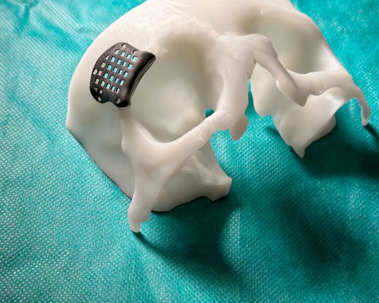 Teil des Schädels in 3D modelliert