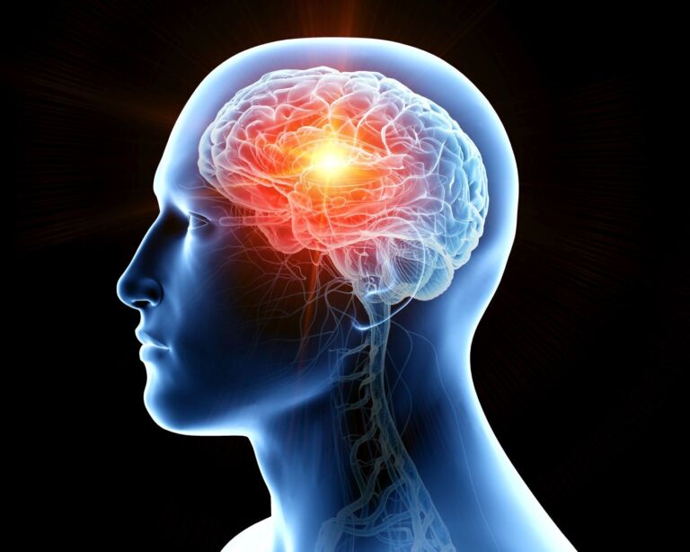 Illustration Hirntumor