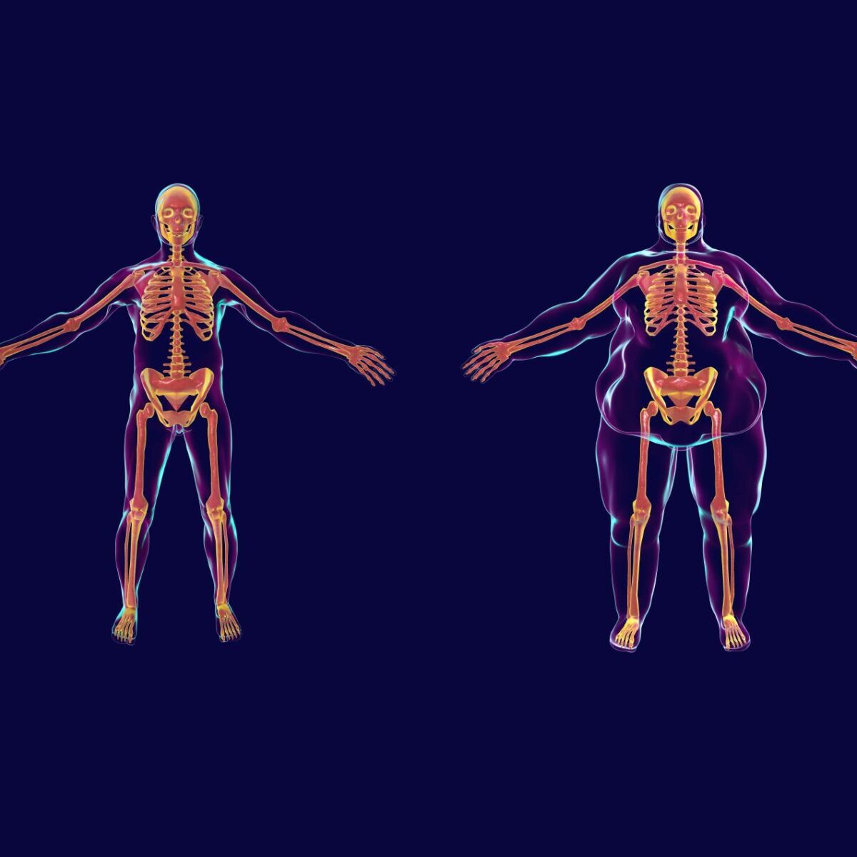 Illustration Fettleibigkeit