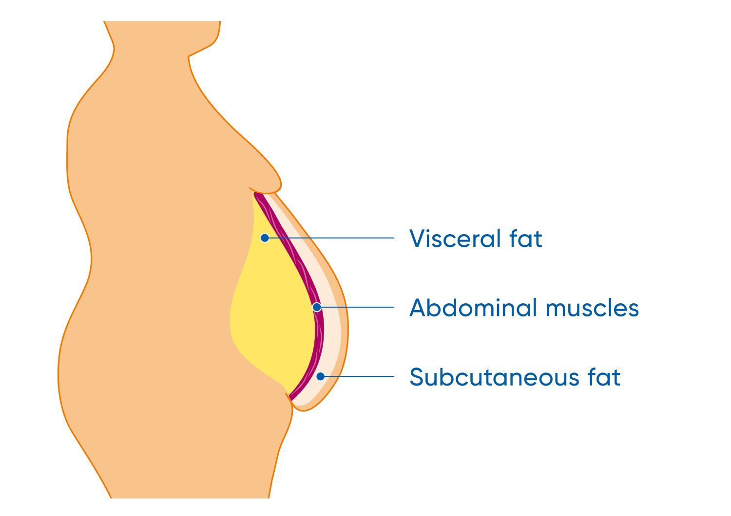 Illustration Fettverteilung Bauchfett