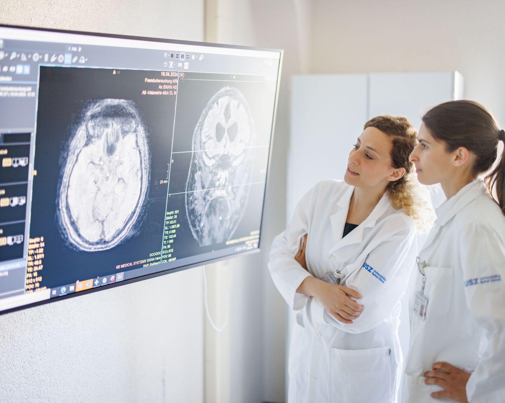 Zwei Ärztinnen schauen auf ein MRI-Bild eines Hirnes