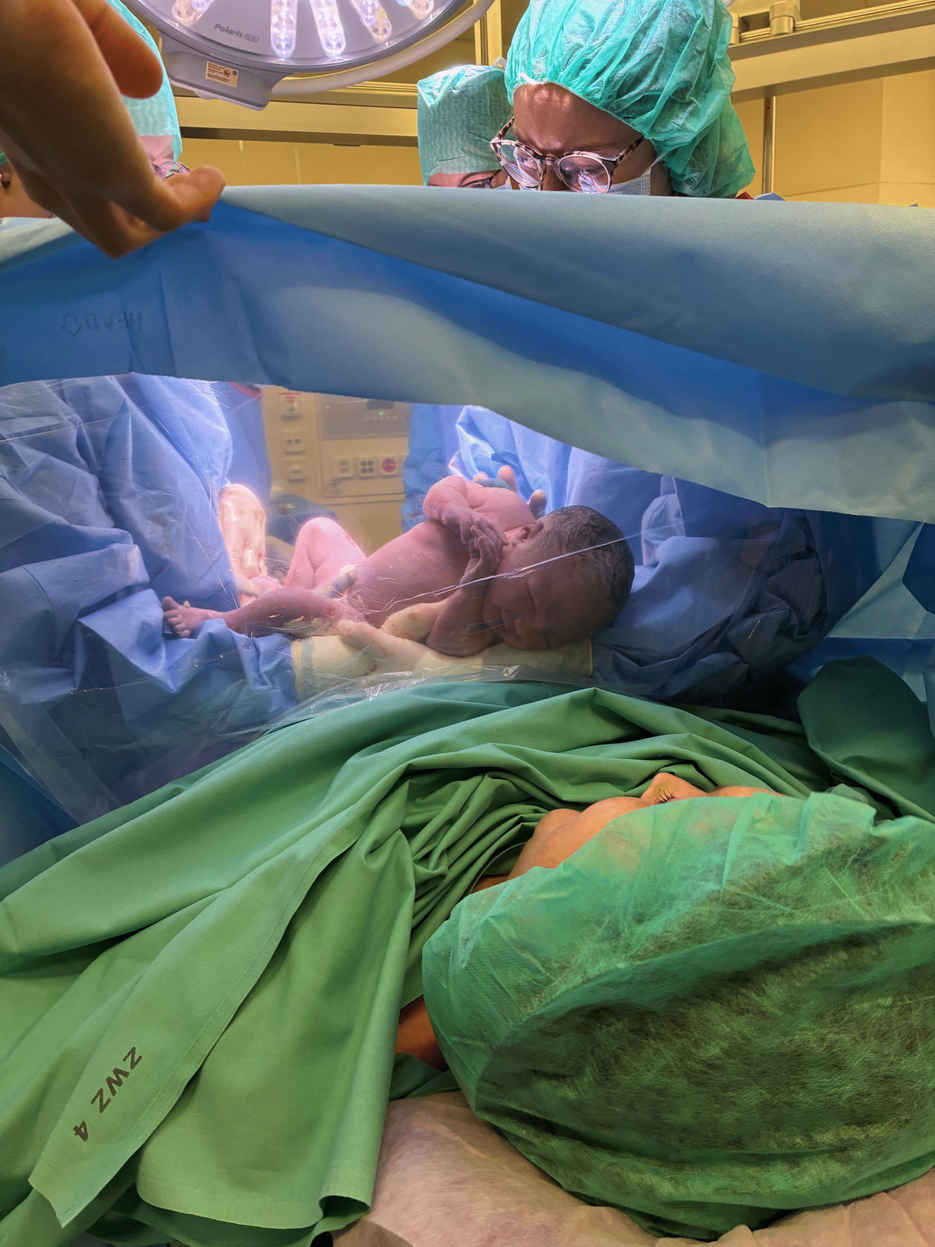 Eine Mutter sieht ihr Baby durch das Fenster beim Kaiserschnitt