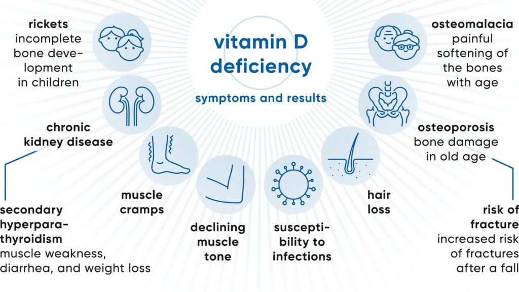 Illustration Vitamin D Mangel Symptome und Folgen