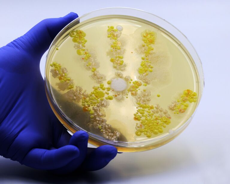 Bakterien- und Pilzkolonien in einer Schale