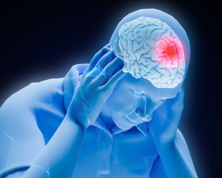 Illustration einer Person mit Schwindel