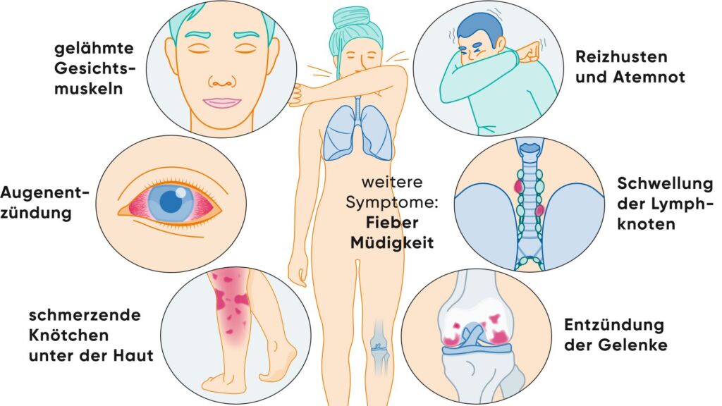Illustration Symptome Sarkoidose