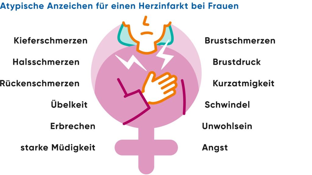 Illustration von atypische Anzeichen für einen Herzinfarkt bei Frauen