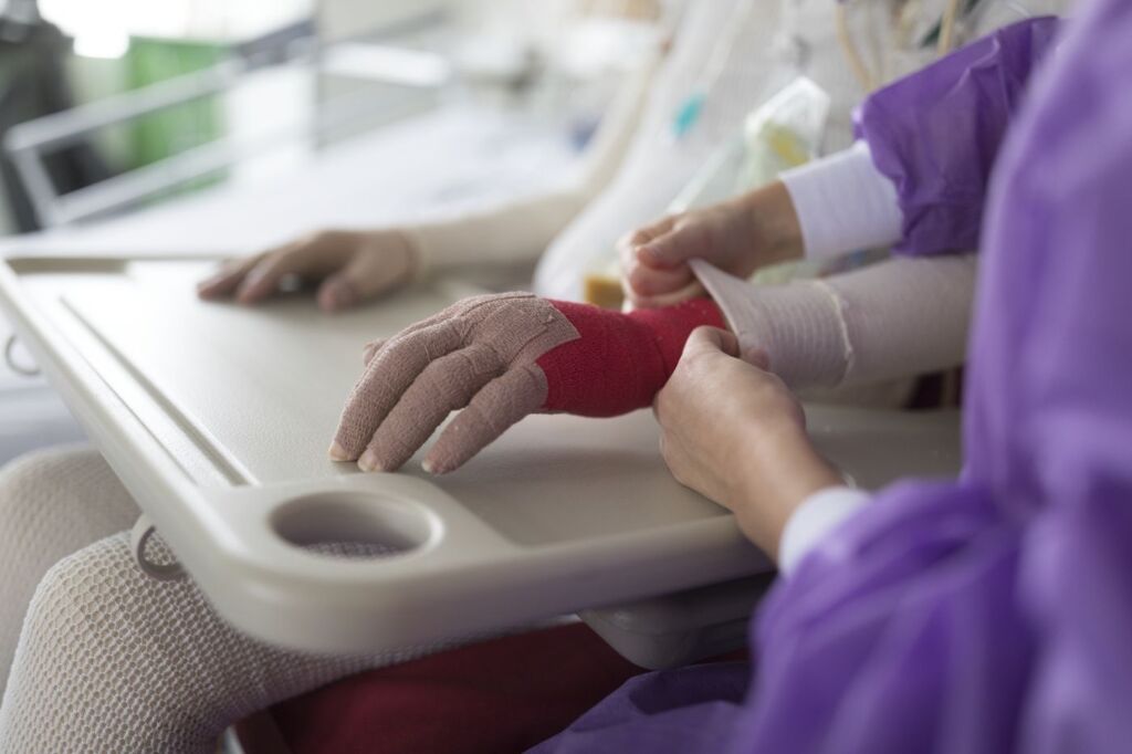 Eingebundene Hände von Brandopfer mit Pflegefachperson