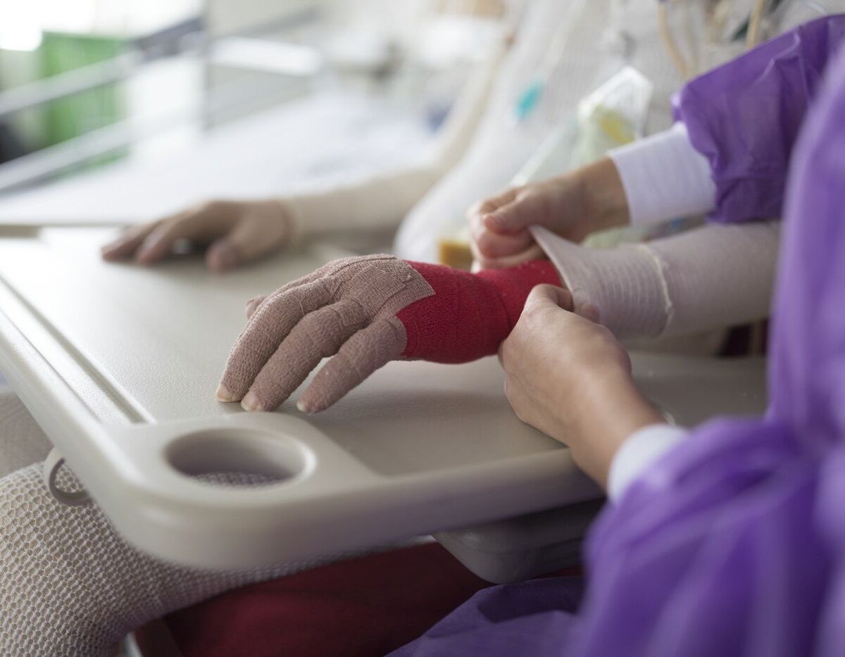 Eingebundene Hände von Brandopfer mit Pflegefachperson