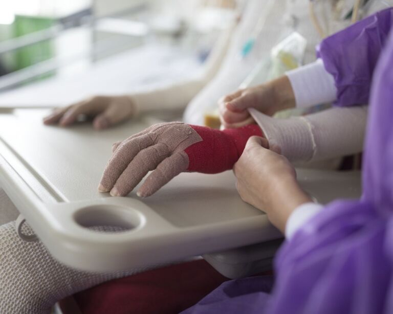 Eingebundene Hände von Brandopfer mit Pflegefachperson