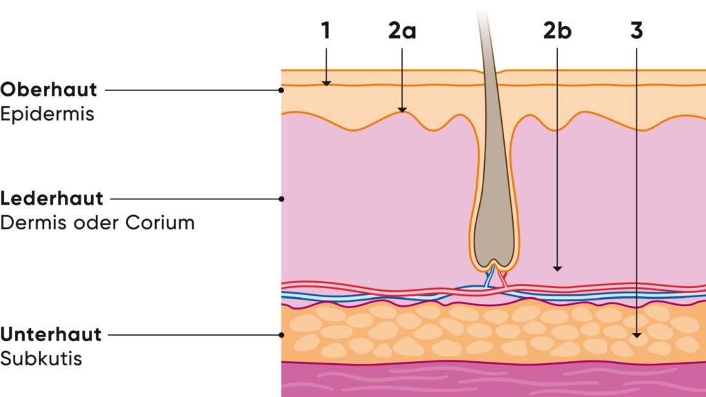 Illustration Verbrennungsgrade 1-3 auf der Haut