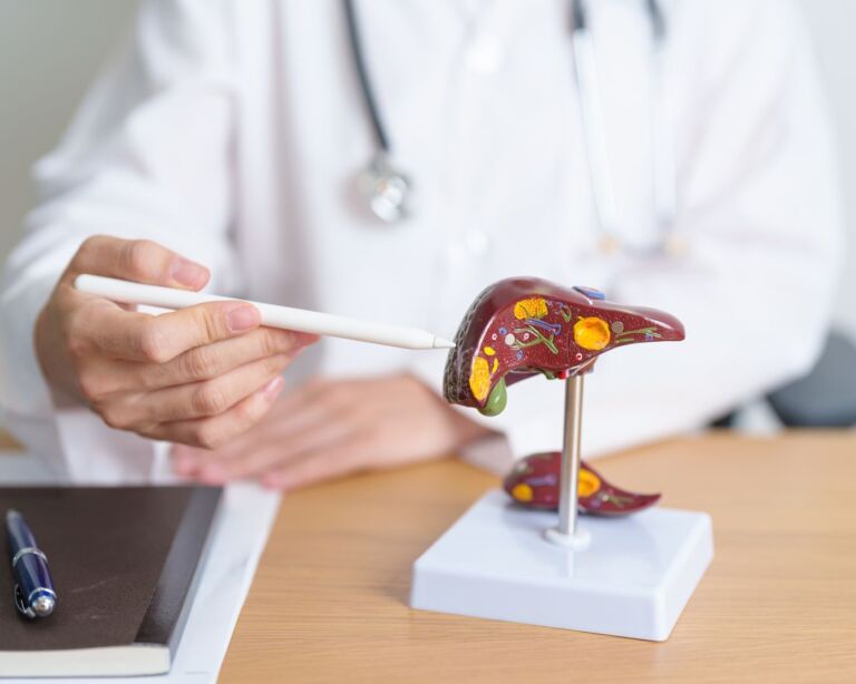 Arzt mit einem anatomischen Modell der menschlichen Leber.