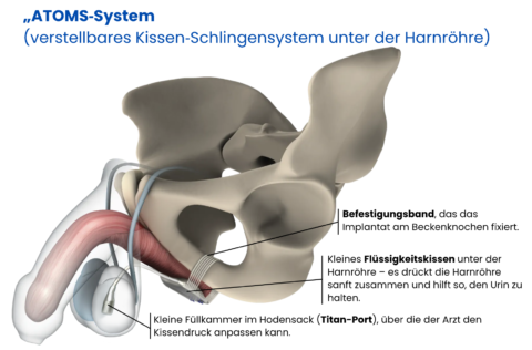 Illustration eines ATOMS Systems