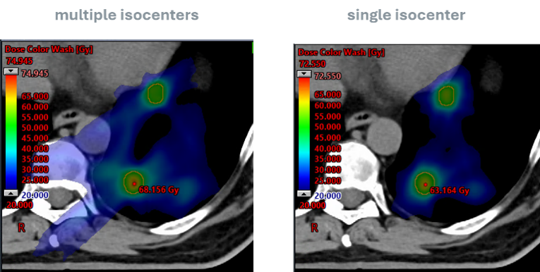Axialer CT-Schnitt mit farbcodierter Dosisdarstellung